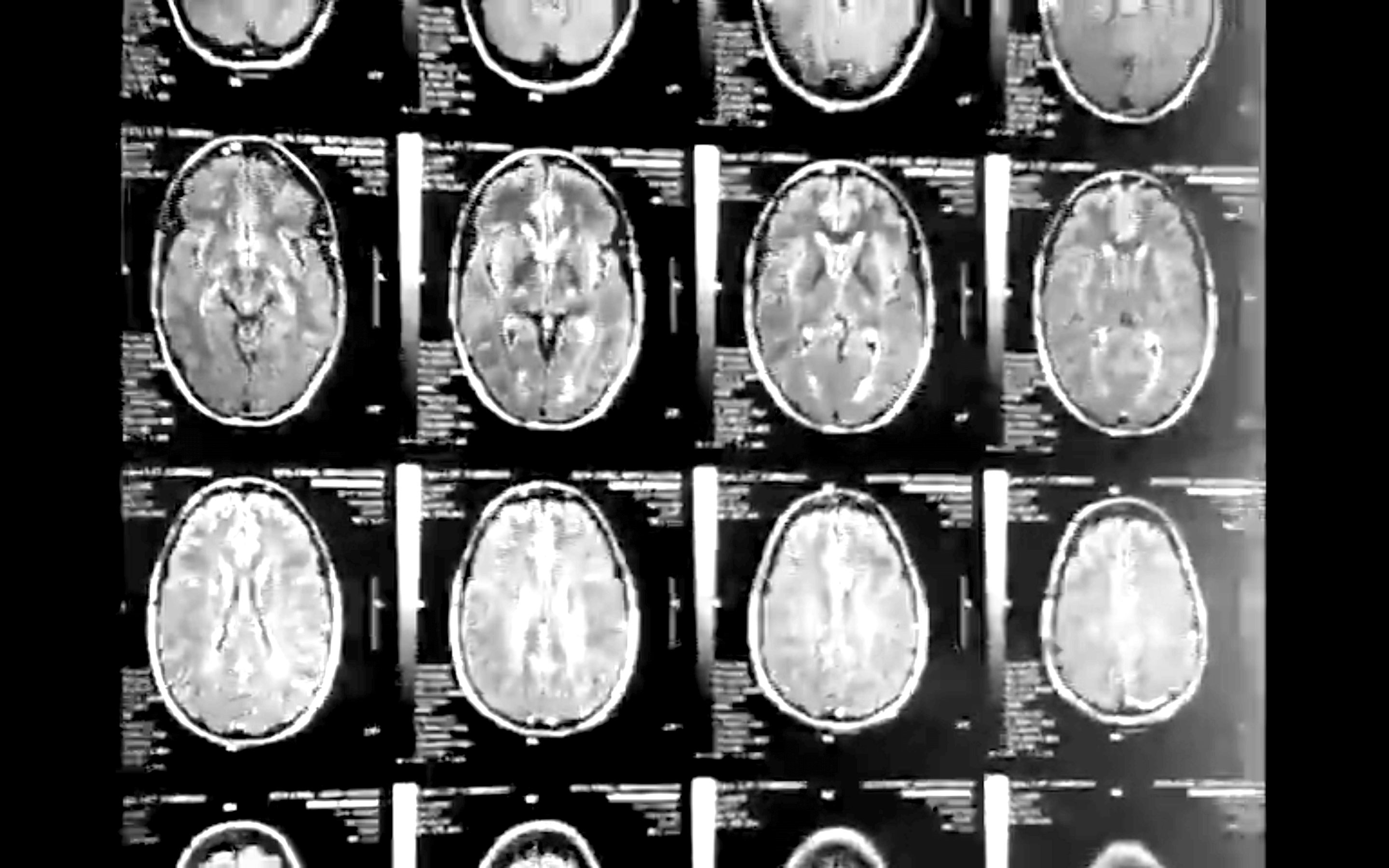 Brain scan images